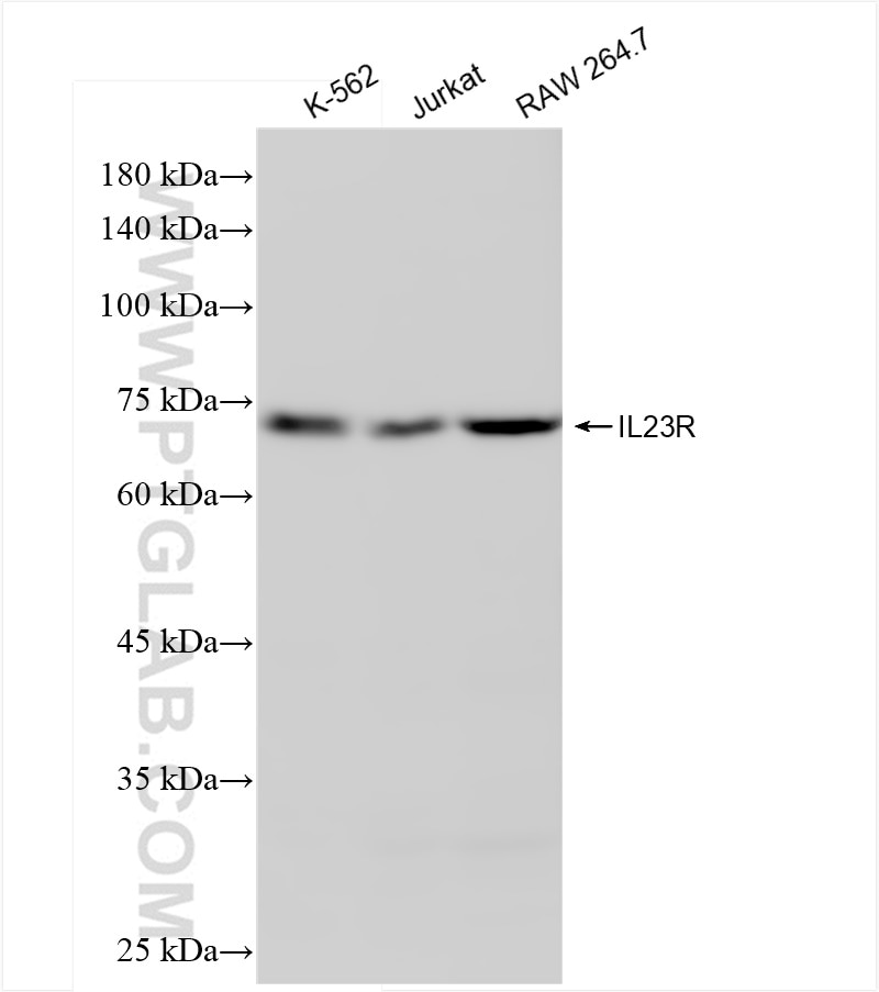 Western Blot (WB) analysis of various lysates using IL-23R Recombinant antibody (83918-3-RR)