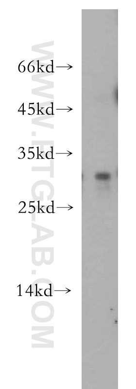 Western Blot (WB) analysis of Recombinant protein using IL-24 Polyclonal antibody (12064-1-AP)