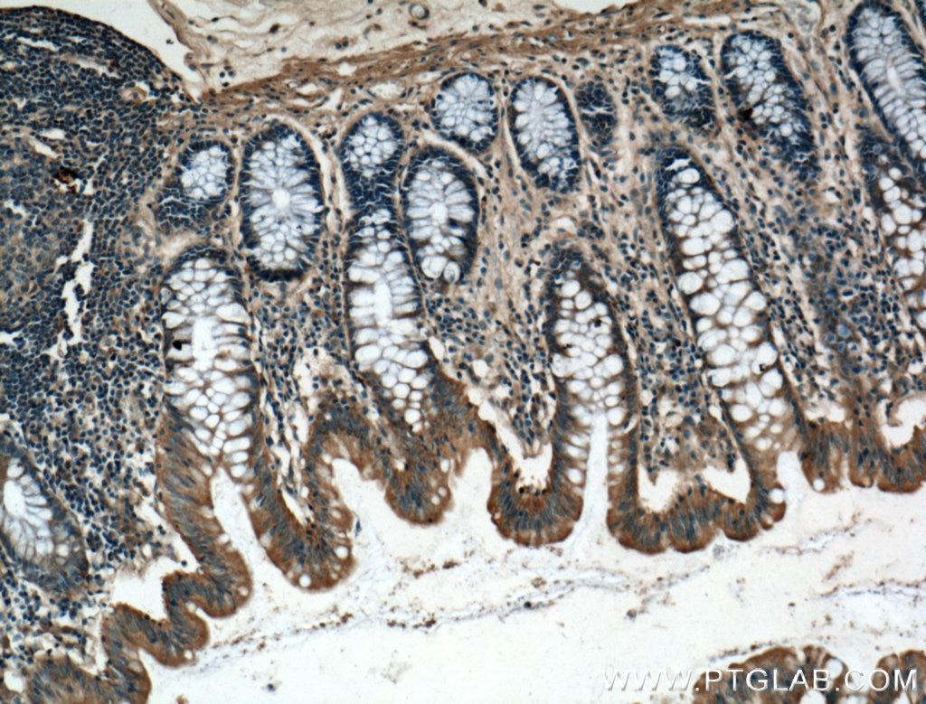 Immunohistochemistry (IHC) staining of human colon tissue using IL-24 Polyclonal antibody (26772-1-AP)