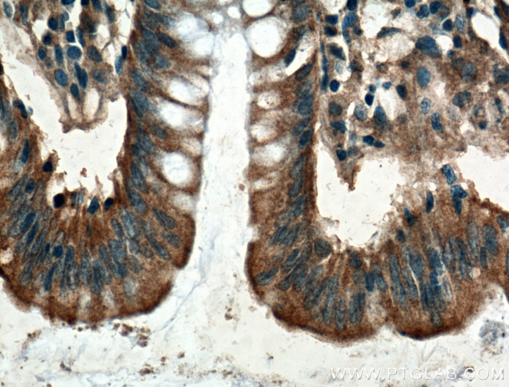 IHC staining of human colon using 26772-1-AP