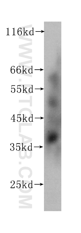 Western Blot (WB) analysis of Recombinant protein using IL-24 Monoclonal antibody (60139-1-Ig)