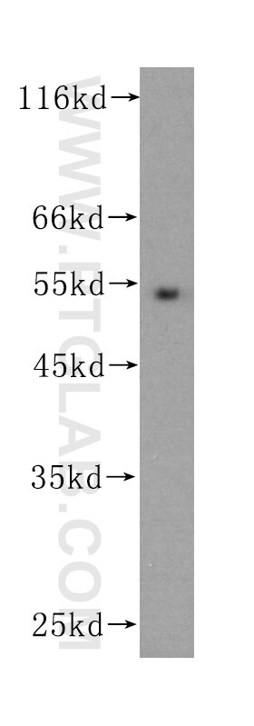 Western Blot (WB) analysis of Recombinant protein using IL-24 Monoclonal antibody (60139-1-Ig)