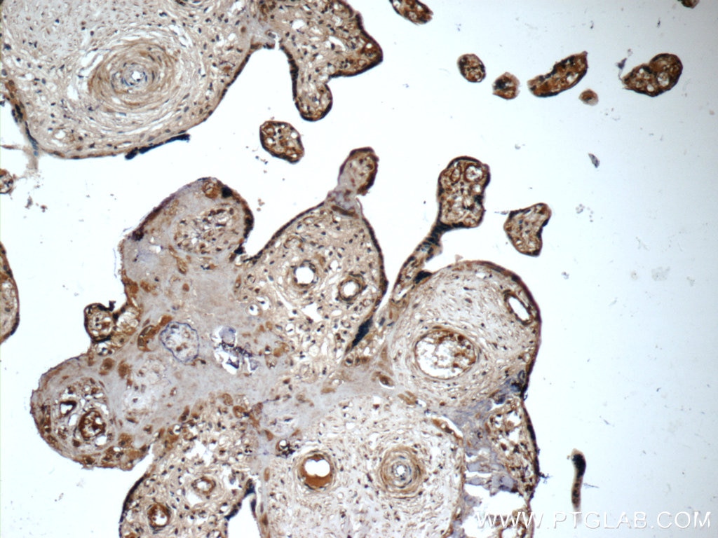 Immunohistochemistry (IHC) staining of human placenta tissue using IL-27 Monoclonal antibody (66164-1-Ig)