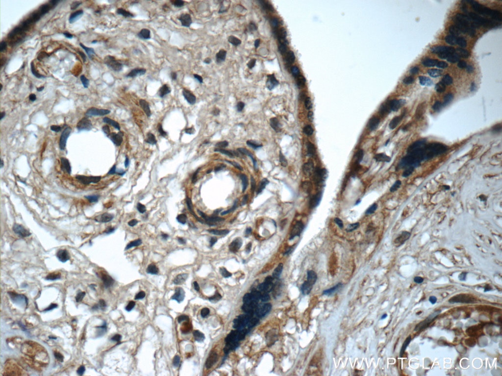 Immunohistochemistry (IHC) staining of human placenta tissue using IL-27 Monoclonal antibody (66164-1-Ig)