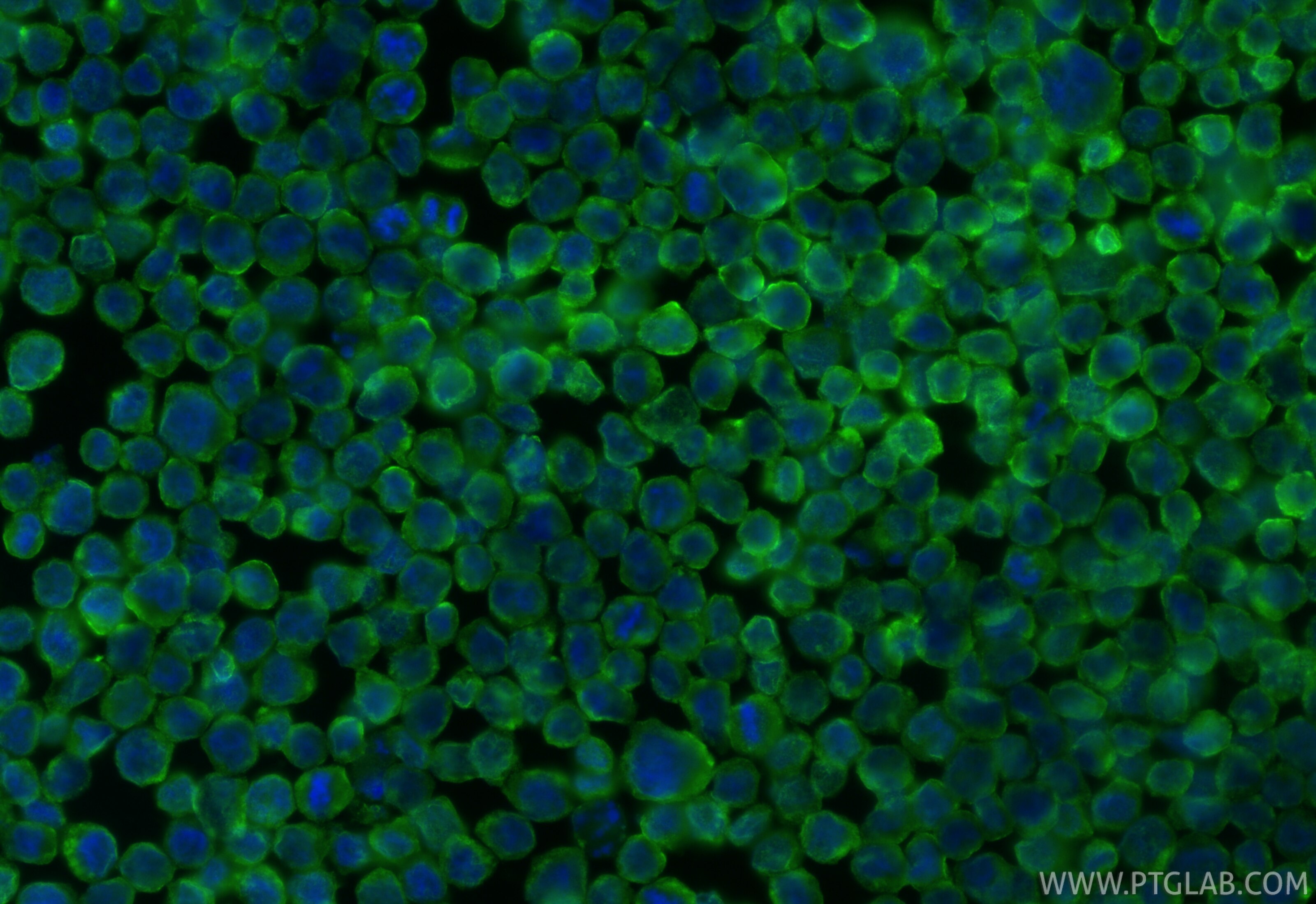 Immunofluorescence (IF) / fluorescent staining of HL-60 cells using IL-27RA Polyclonal antibody (12308-1-AP)