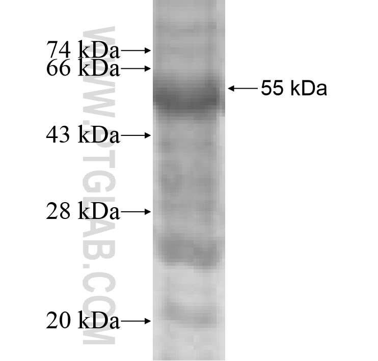 IL-27RA fusion protein Ag9133 SDS-PAGE