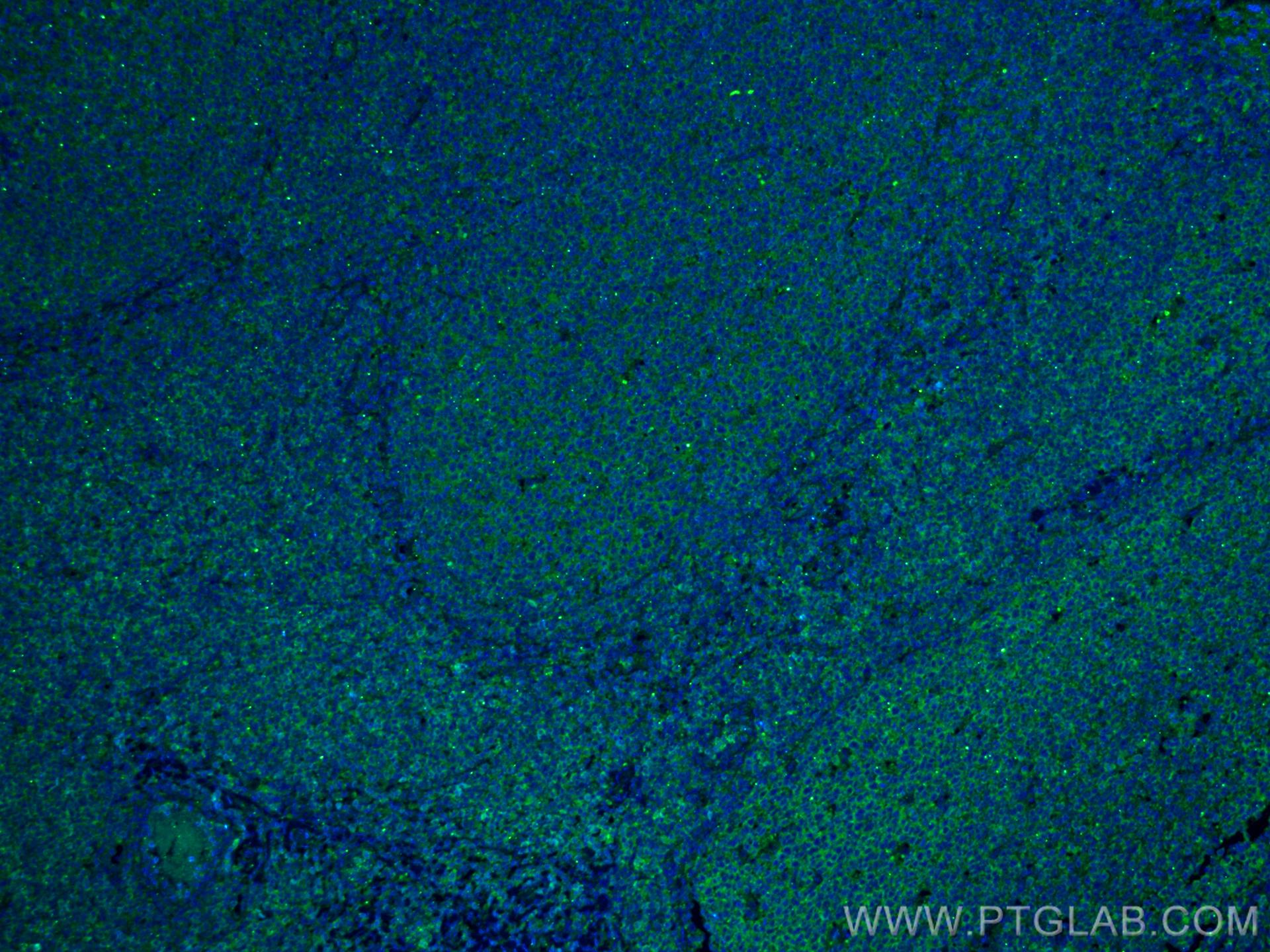 Immunofluorescence (IF) / fluorescent staining of human tonsillitis tissue using IL-28A Monoclonal antibody (60270-1-Ig)