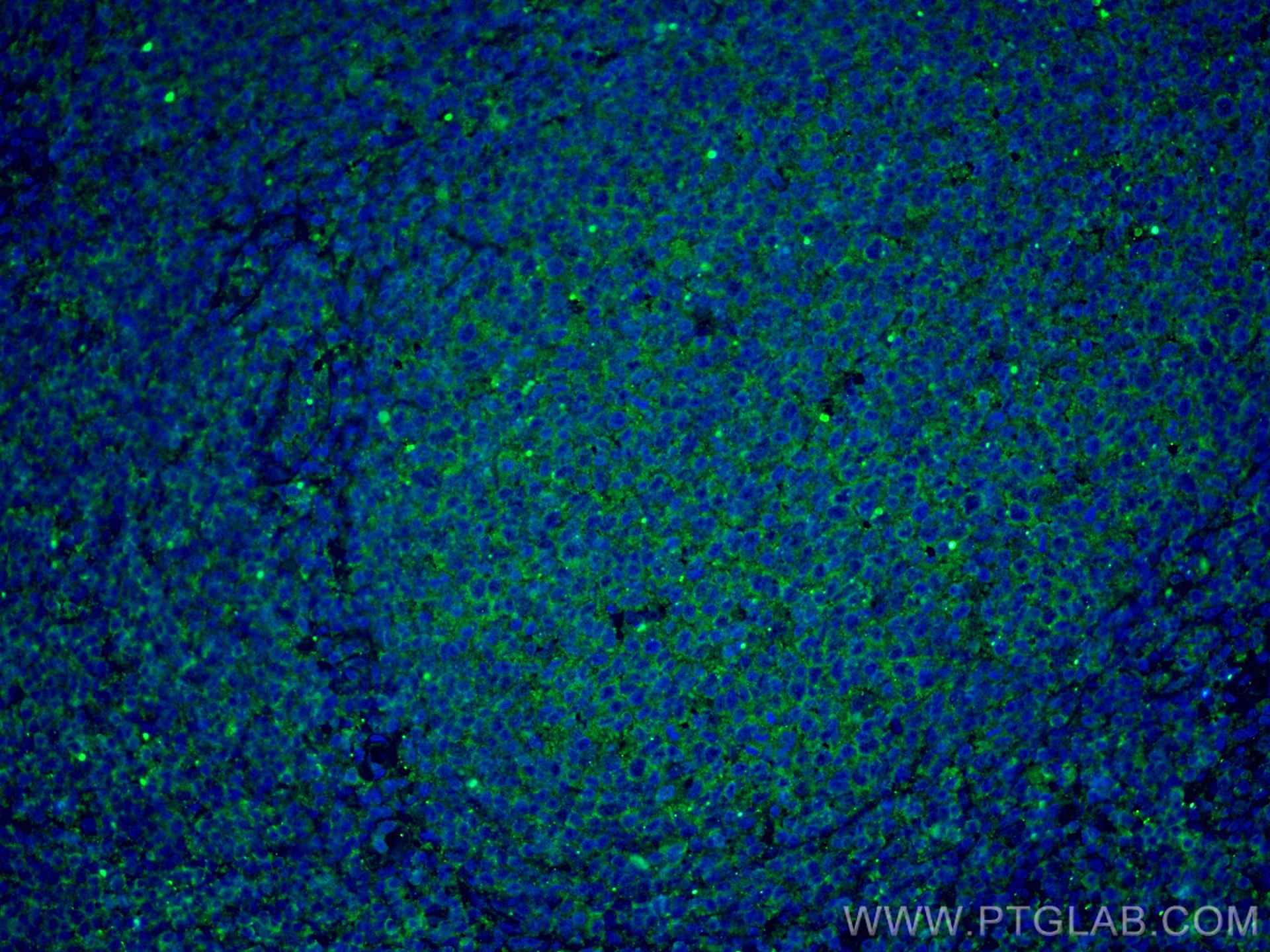 Immunofluorescence (IF) / fluorescent staining of human tonsillitis tissue using IL-28A Monoclonal antibody (60270-1-Ig)