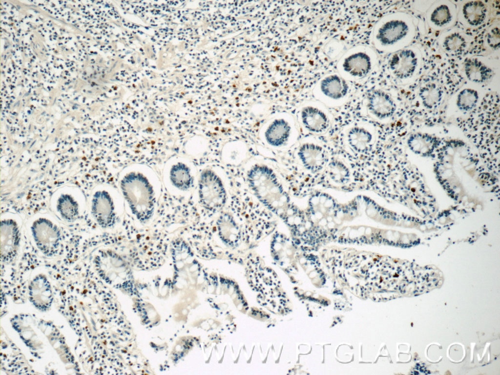 Immunohistochemistry (IHC) staining of human small intestine tissue using IL-28A Monoclonal antibody (60270-1-Ig)