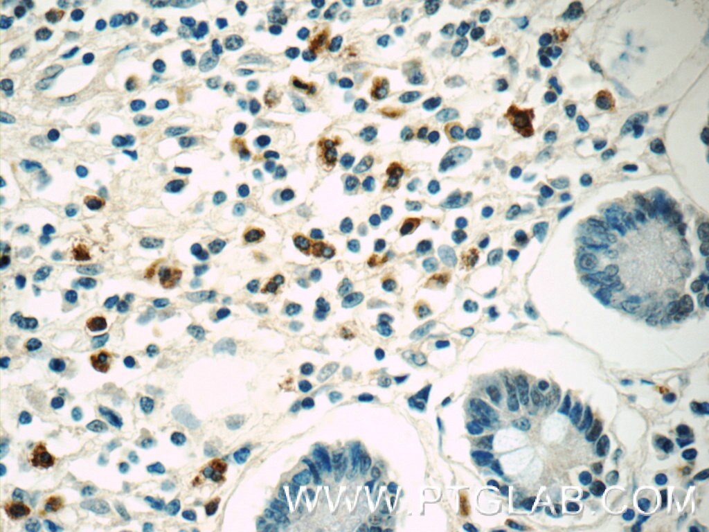 Immunohistochemistry (IHC) staining of human small intestine tissue using IL-28A Monoclonal antibody (60270-1-Ig)
