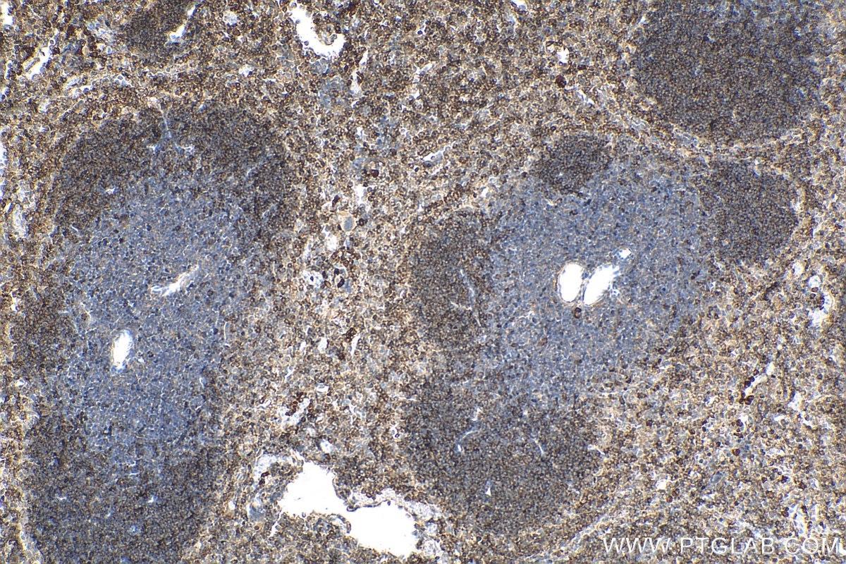 Immunohistochemistry (IHC) staining of mouse spleen tissue using CD122/IL-2RB Polyclonal antibody (13602-1-AP)
