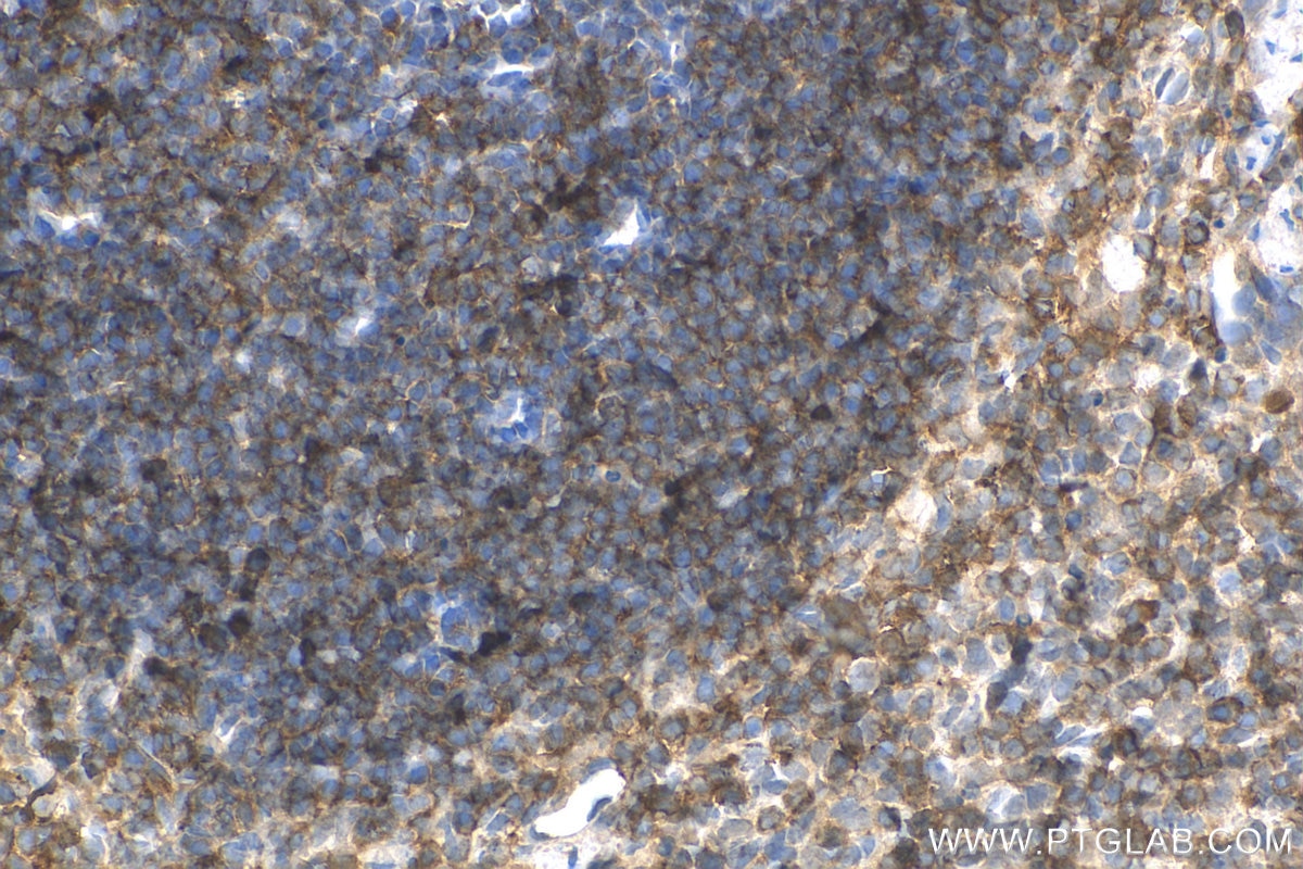 Immunohistochemistry (IHC) staining of mouse spleen tissue using CD122/IL-2RB Polyclonal antibody (13602-1-AP)