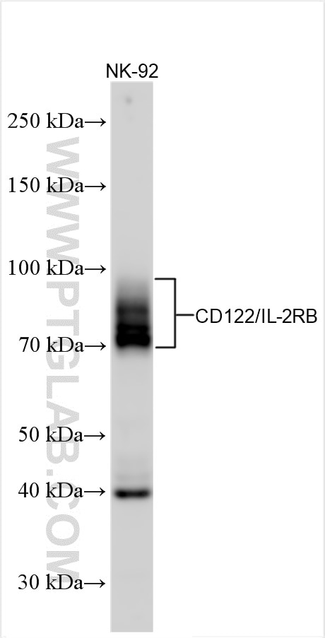 Western Blot (WB) analysis of various lysates using CD122/IL-2RB Polyclonal antibody (13602-1-AP)