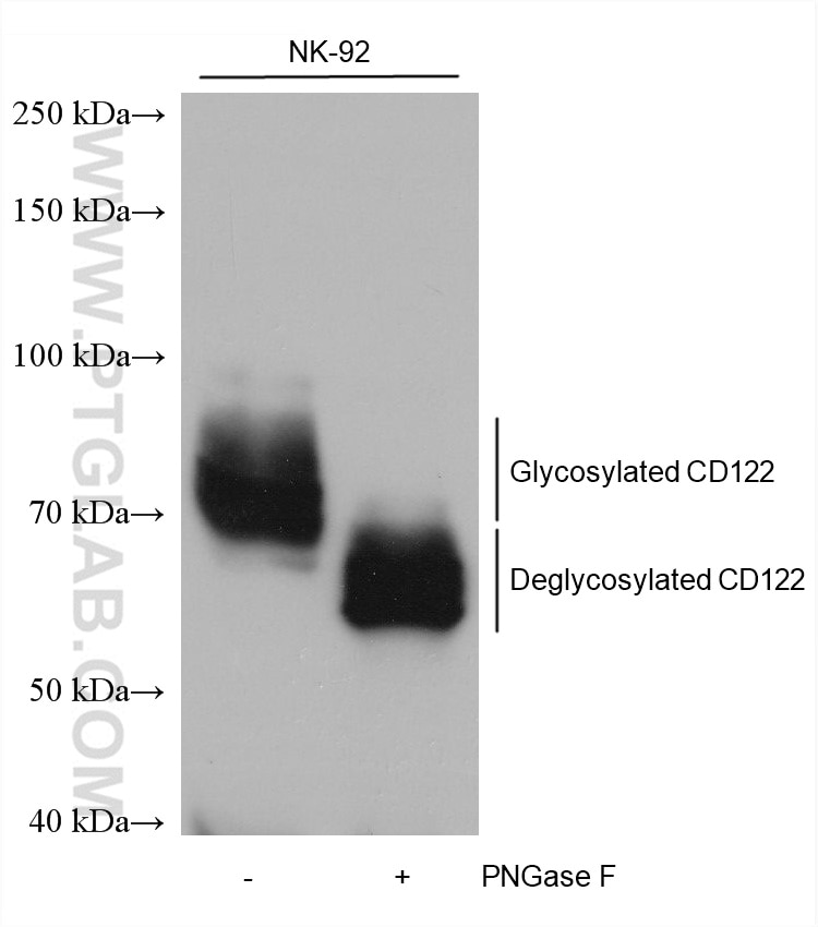 Western Blot (WB) analysis of various lysates using CD122/IL2RB Monoclonal antibody (60174-1-Ig)