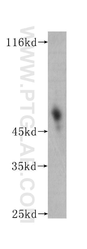 Western Blot (WB) analysis of Recombinant protein using CD122/IL2RB Monoclonal antibody (60174-1-Ig)