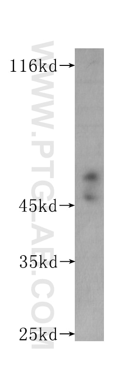 Western Blot (WB) analysis of Recombinant protein using CD122/IL2RB Monoclonal antibody (60174-2-Ig)