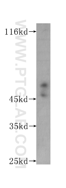 Western Blot (WB) analysis of Recombinant protein using CD122/IL-2RB Monoclonal antibody (60174-2-Ig)