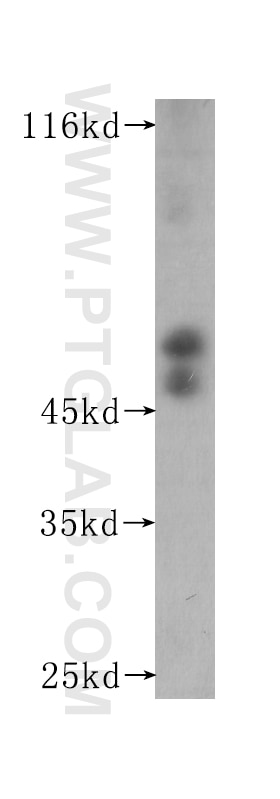 Western Blot (WB) analysis of Recombinant protein using CD122/IL-2RB Monoclonal antibody (60174-2-Ig)