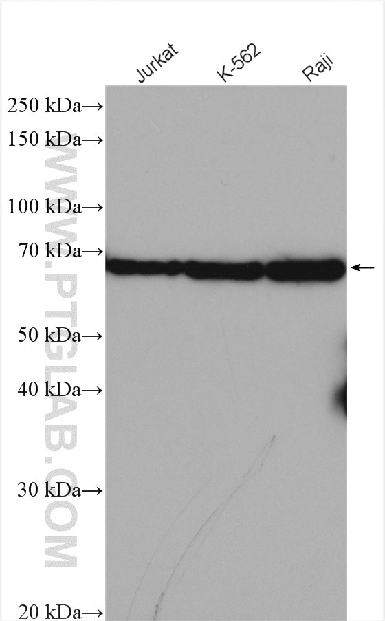 Western Blot (WB) analysis of various lysates using IL2RG Polyclonal antibody (11409-1-AP)