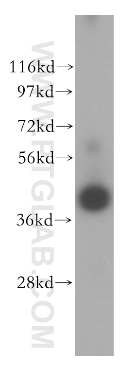 IL2RG Polyclonal antibody