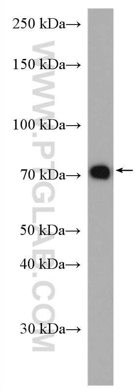 Western Blot (WB) analysis of Raji cells using IL-2RG Polyclonal antibody (27377-1-AP)