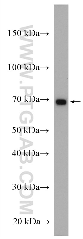 Western Blot (WB) analysis of Jurkat cells using IL-2RG Polyclonal antibody (27377-1-AP)