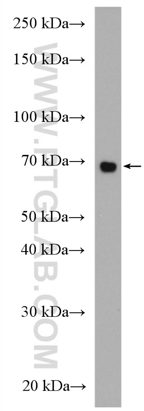 Western Blot (WB) analysis of K-562 cells using IL-2RG Polyclonal antibody (27377-1-AP)