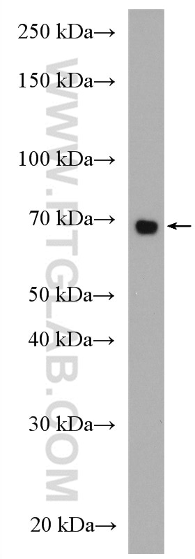 WB analysis of K-562 using 27377-1-AP