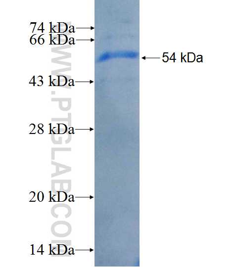 IL2RG fusion protein Ag26388 SDS-PAGE