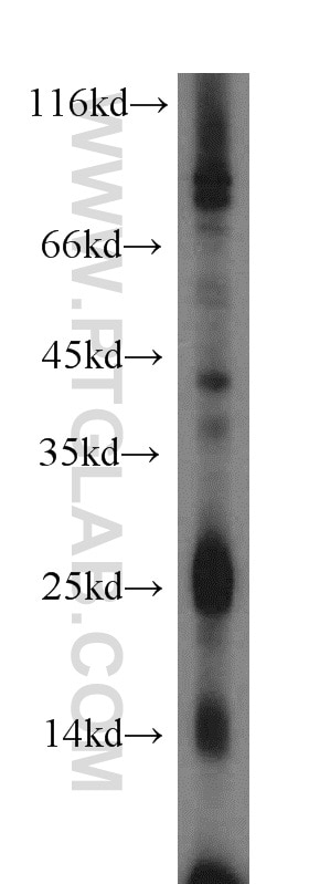 Western Blot (WB) analysis of Recombinant protein using IL-3 Polyclonal antibody (17835-1-AP)