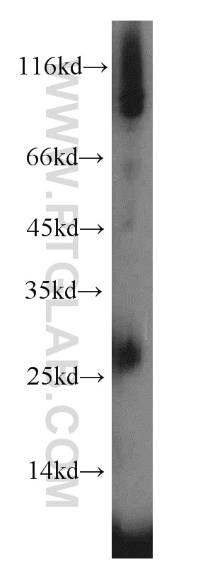 Western Blot (WB) analysis of Recombinant protein using IL-3 Polyclonal antibody (17835-1-AP)