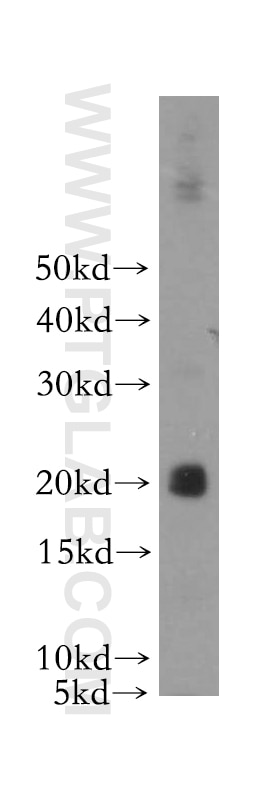 Western Blot (WB) analysis of Recombinant protein using IL-3 Polyclonal antibody (17835-1-AP)