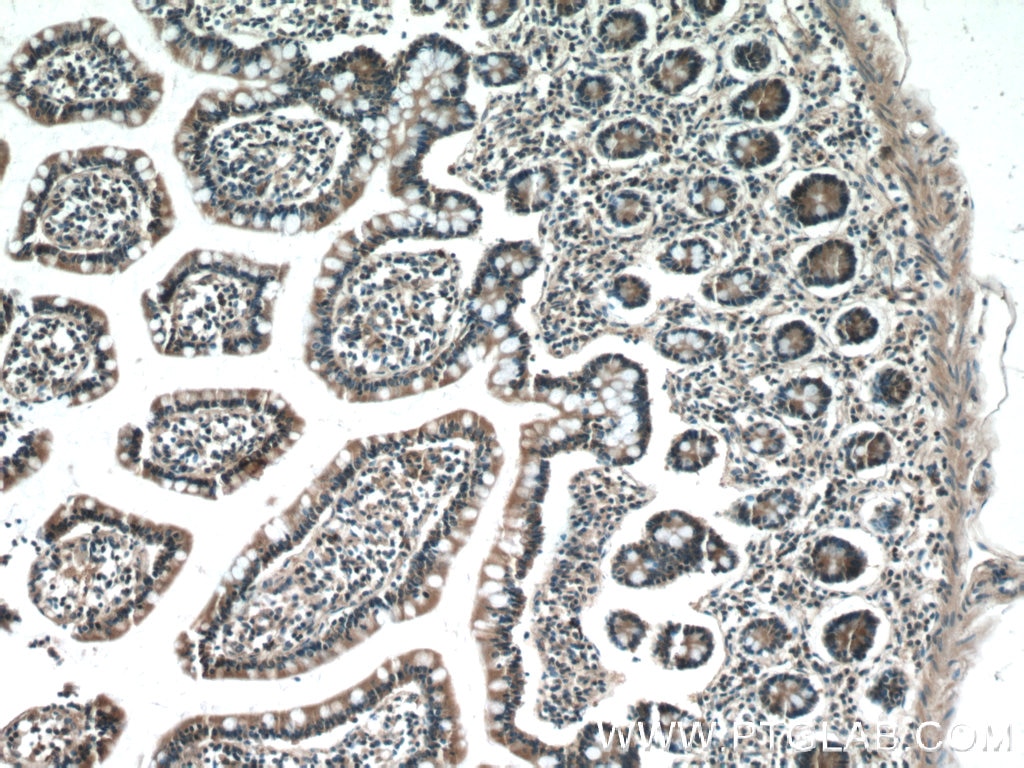 Immunohistochemistry (IHC) staining of human small intestine tissue using IL-31 Polyclonal antibody (22859-1-AP)