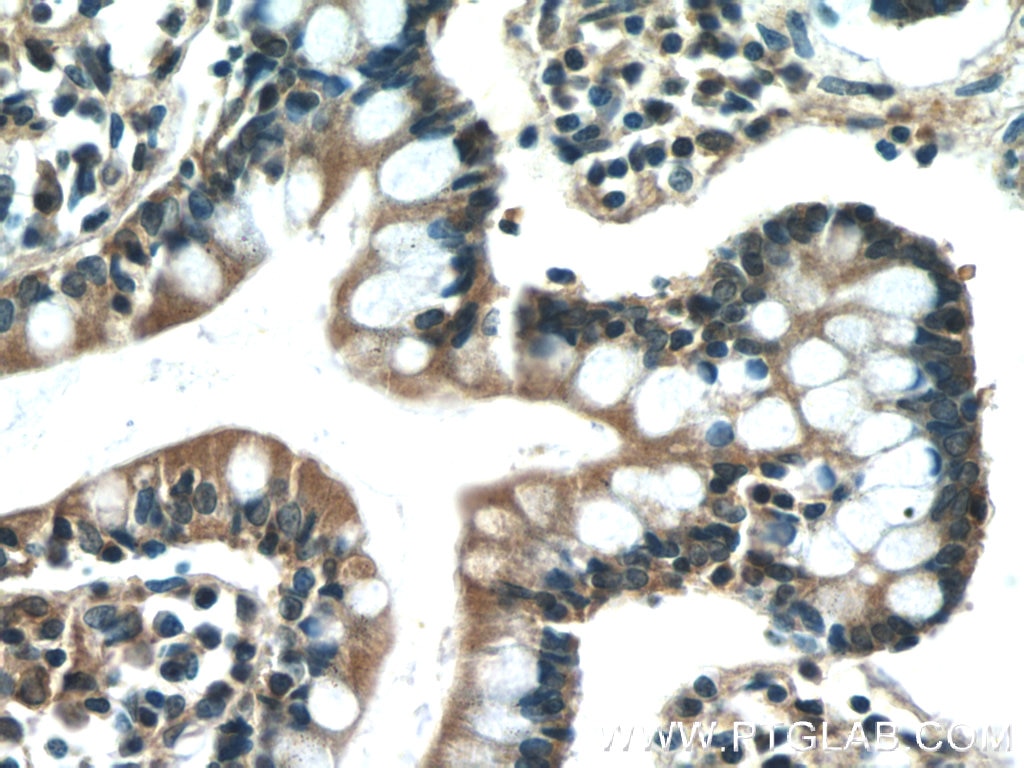 Immunohistochemistry (IHC) staining of human small intestine tissue using IL-31 Polyclonal antibody (22859-1-AP)