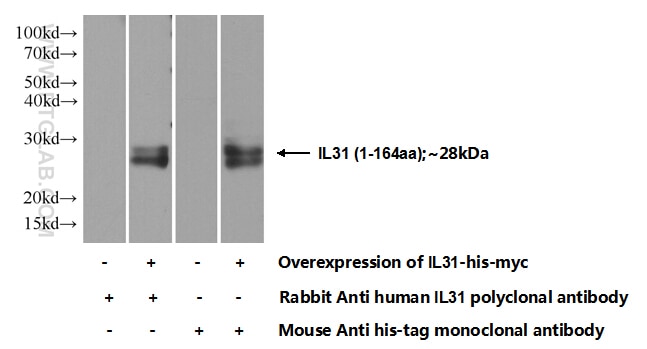 IL-31 Polyclonal antibody