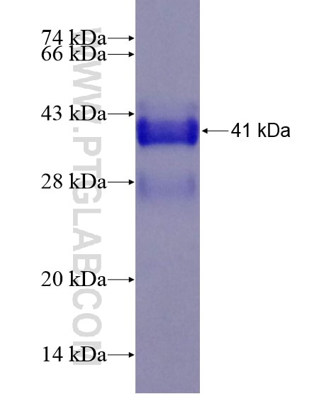 IL-31 fusion protein Ag18848 SDS-PAGE