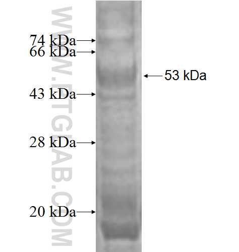 IL-32 fusion protein Ag1484 SDS-PAGE