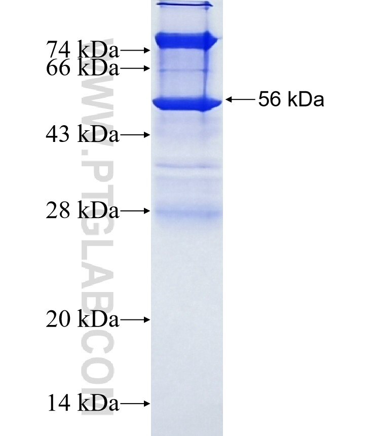 IL-32 fusion protein Ag1484 SDS-PAGE