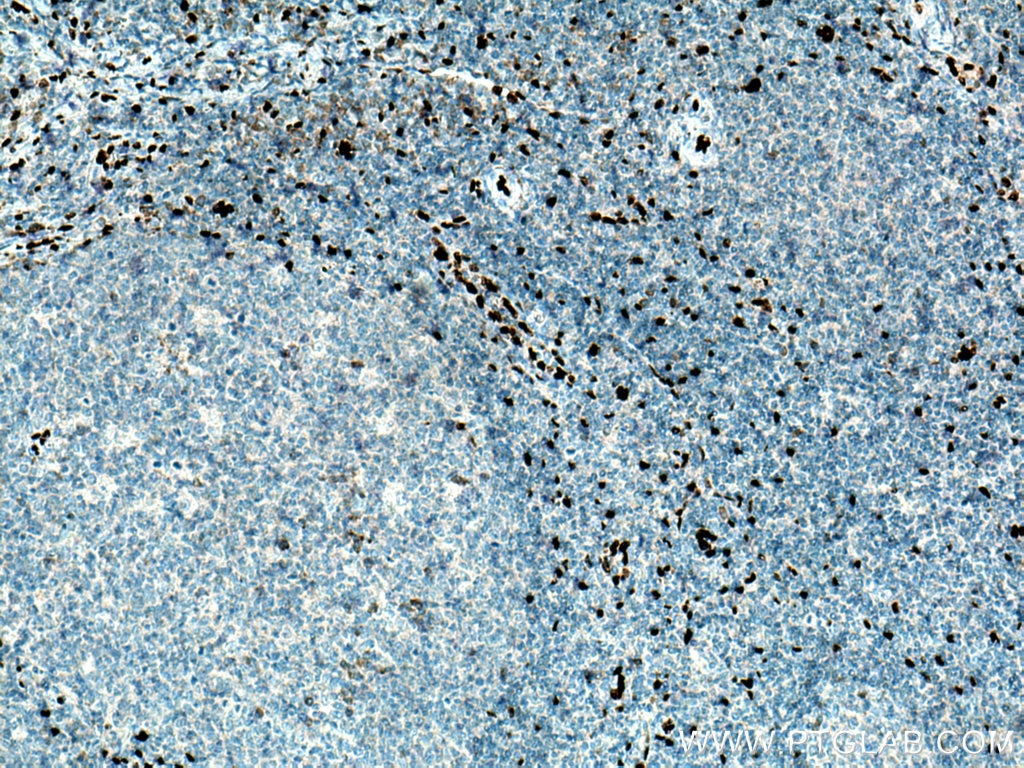 Immunohistochemistry (IHC) staining of human tonsillitis tissue using IL-33 Polyclonal antibody (12372-1-AP)