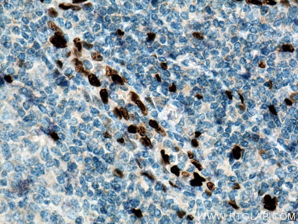Immunohistochemistry (IHC) staining of human tonsillitis tissue using IL-33 Polyclonal antibody (12372-1-AP)