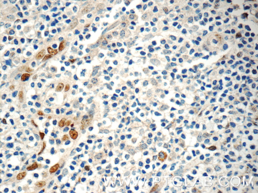 IL-33 Polyclonal antibody
