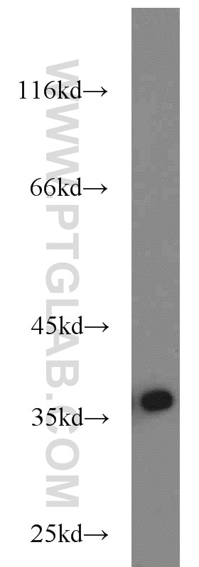 WB analysis of Recombinant protein using 12372-1-AP