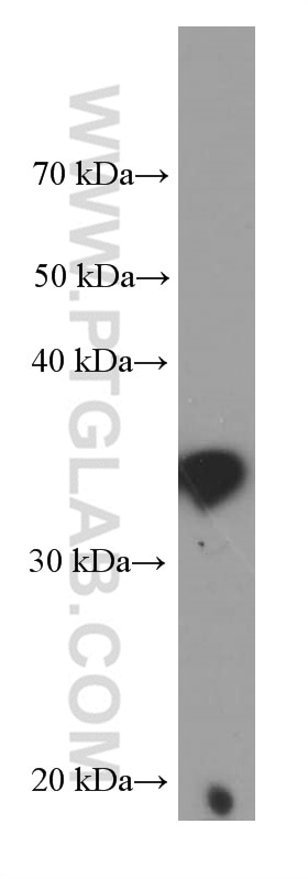 WB analysis of human lung using 66235-1-Ig