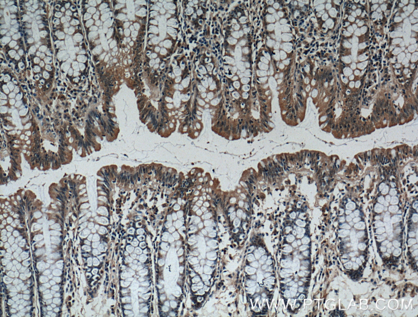 Immunohistochemistry (IHC) staining of human colon tissue using IL-1F7/IL-37 Monoclonal antibody (60296-1-Ig)