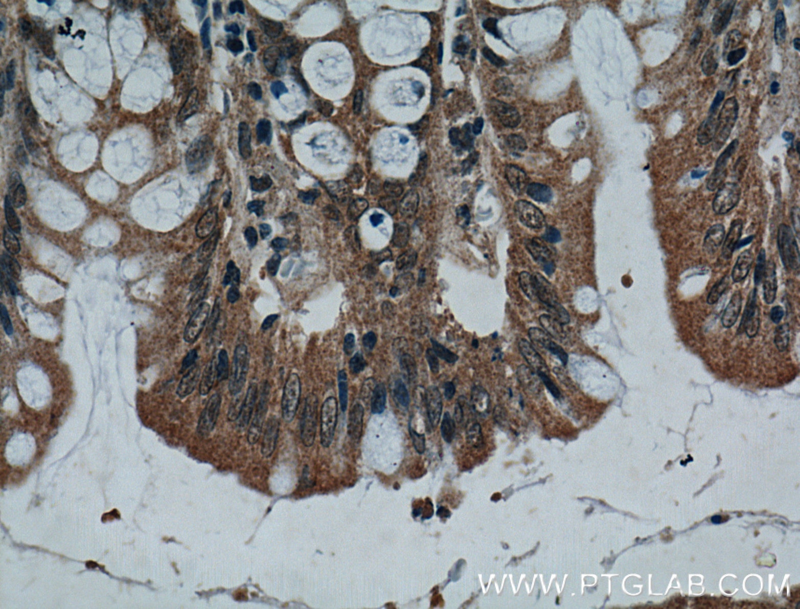 IHC staining of human colon using 60296-1-Ig