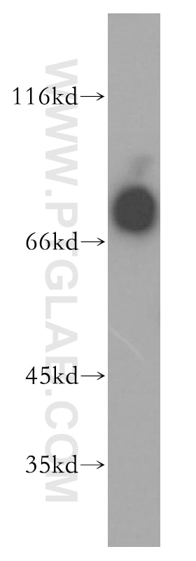 Western Blot (WB) analysis of HL-60 cells using IL-3RA Polyclonal antibody (13655-1-AP)