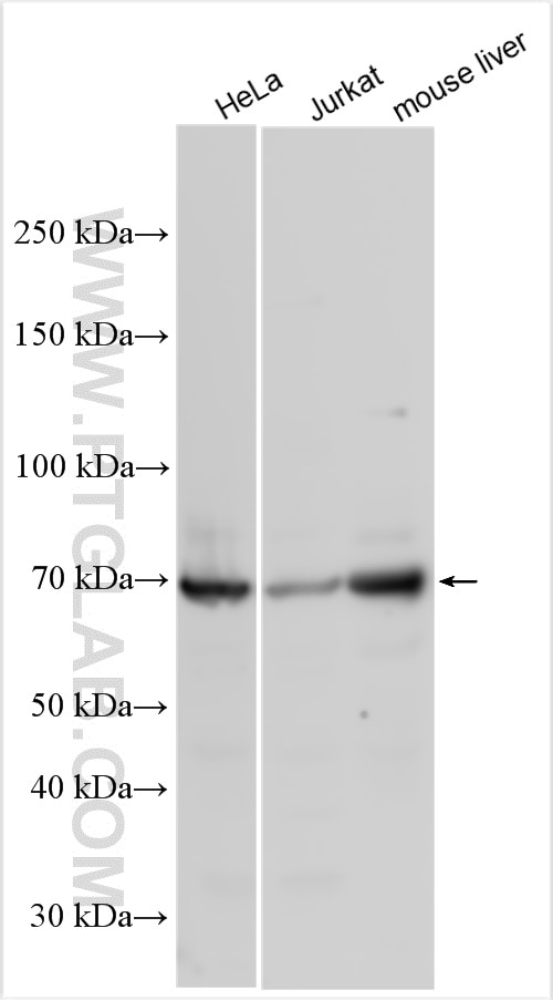 Western Blot (WB) analysis of various lysates using IL-4I1 Polyclonal antibody (23048-1-AP)