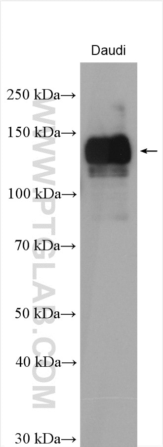 Western Blot (WB) analysis of various lysates using IL-4RA/CD124 Polyclonal antibody (28331-1-AP)