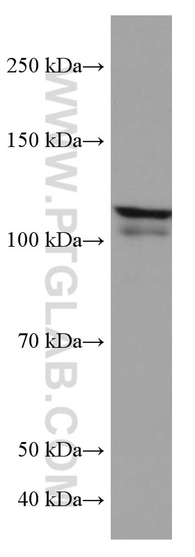 Western Blot (WB) analysis of HeLa cells using IL-4R Monoclonal antibody (67051-1-Ig)
