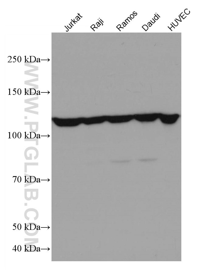 Western Blot (WB) analysis of various lysates using IL-4R Monoclonal antibody (67051-1-Ig)